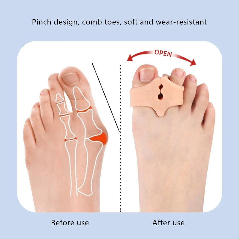 Silicone Toe Spreader & Bunion Corrector