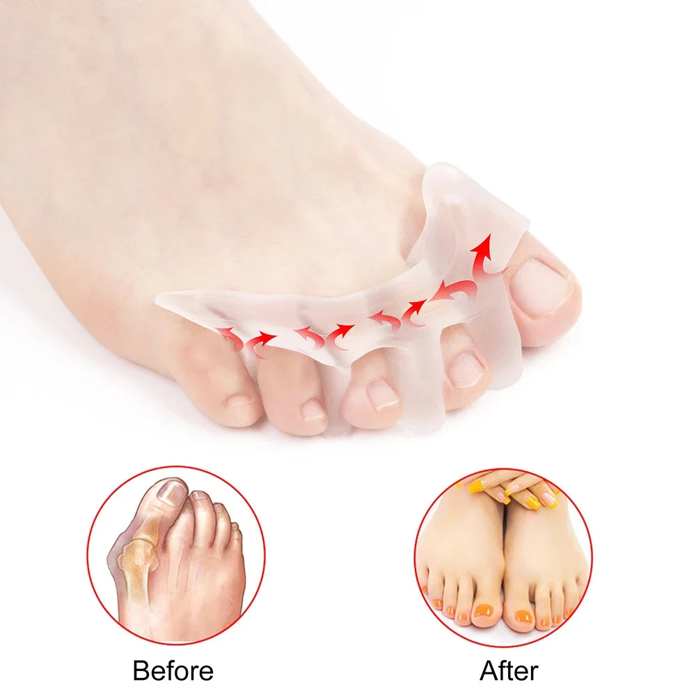 Gel Toe Separator for Athletes & Dancers